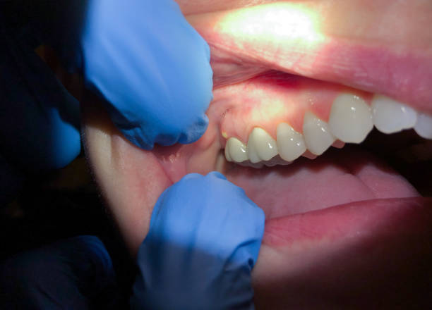 Best Cracked Tooth Emergency Dentist  in Vienna, IL