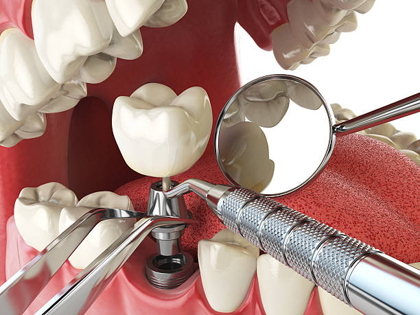 Best Broken Tooth Emergency  in Vienna, IL